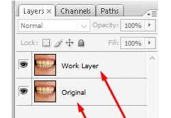 brighten teeth photoshop