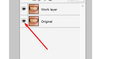 how to brighten teeth in photoshop