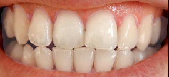 whiten human teeth in abode photoshop